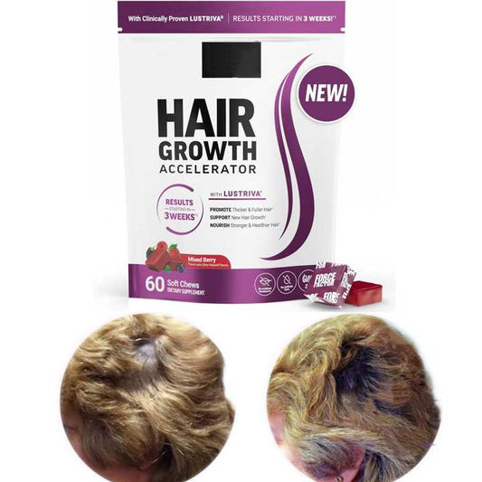 Aloe Vera Hair Growth Gummies™